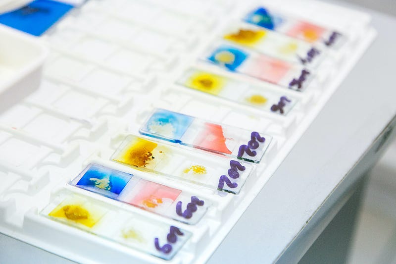 Slides with cells covered in various stains, labeled and placed on a slide tray.